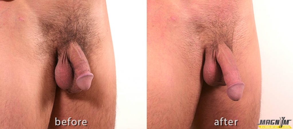 magnym™ before and after photo 1 large 1024x453